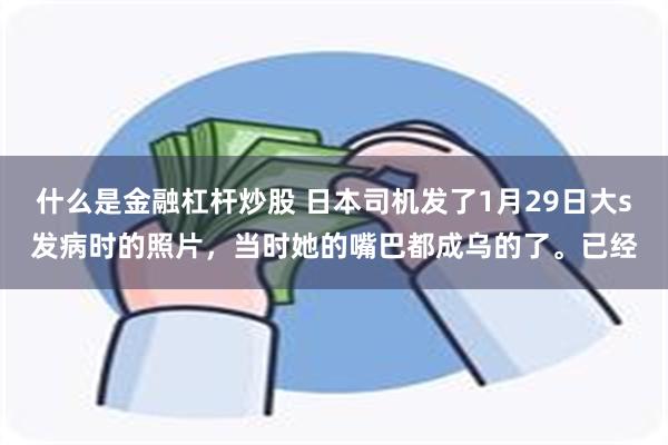什么是金融杠杆炒股 日本司机发了1月29日大s发病时的照片，当时她的嘴巴都成乌的了。已经